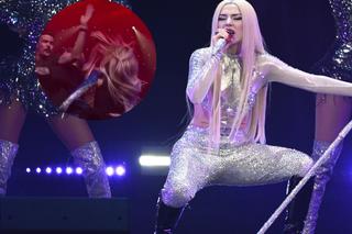 Ava Max spoliczkowana przez fana! Jej oko jest mocno zadrapane