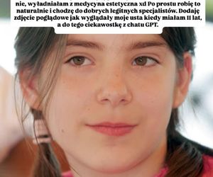 Natalia Zambrzycka (Agata z serialu Barwy szczęścia) powiększa sobie usta od lat. Tak wyglądała jako 11-latka