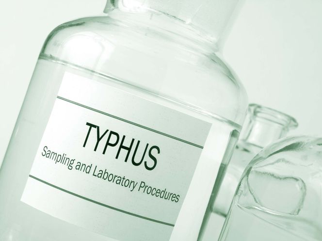 Tyfus (dur)