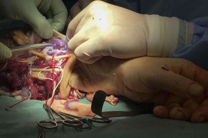 PIERWSZY TEGO TYPU PRZESZCZEP.