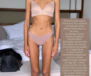 Klaudia El Dursi pokazała zdjęcie z okresu, kiedy ważyła 47 kilo! Straszny czas