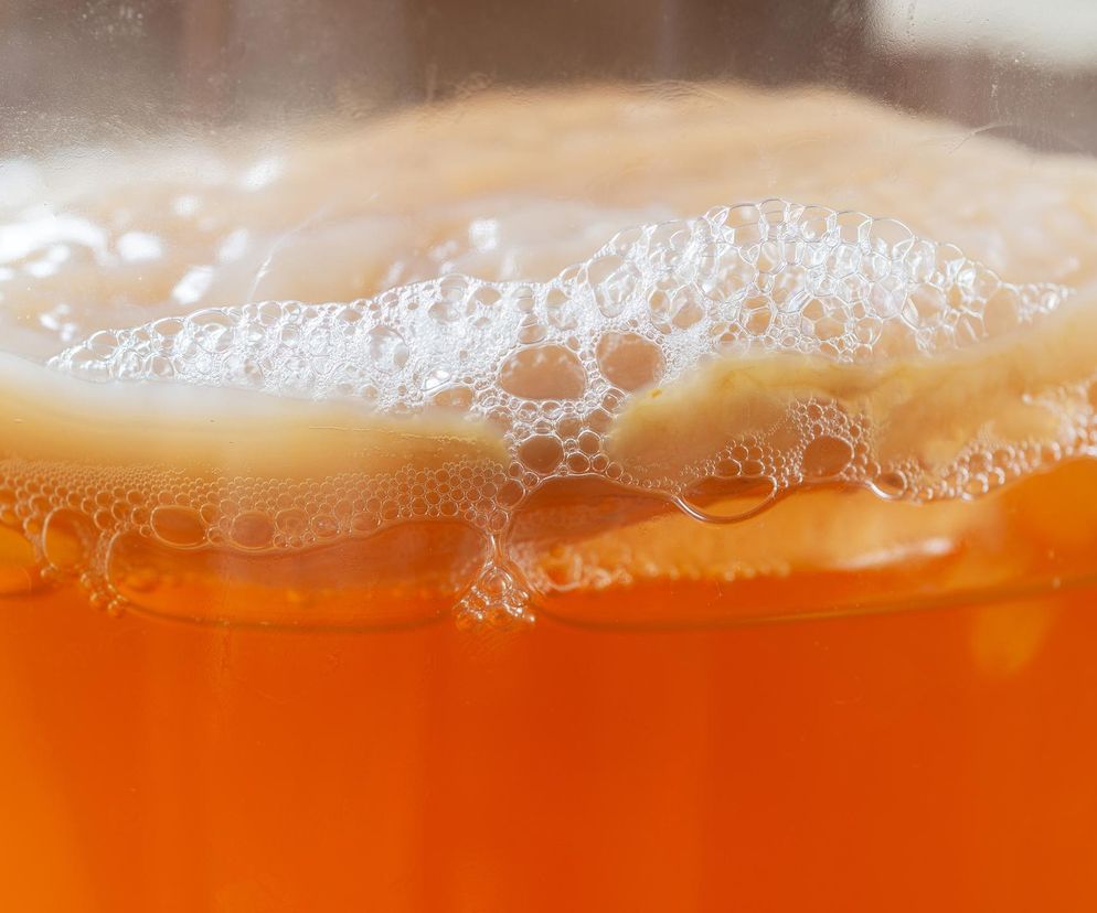 Polacy ją uwielbiają, ale trzeba uważać. Problemy z zębami to jedna z konsekwencji 