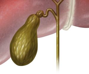Rak pęcherzyka żółciowego: przyczyny, objawy, leczenie i rokowania