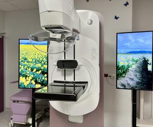 Najnowocześniejsze w Polsce urządzenie do mammografii jest w Radomiu. Więcej kobiet będzie mogło wziąć udział w badaniach