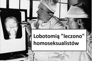 W tych przypadkach stosowano lobotomię