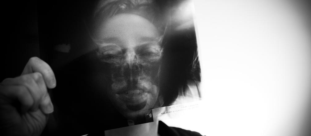 Piotr Grzybowski - I miejsce w kategorii ŻYCIE CODZIENNE 