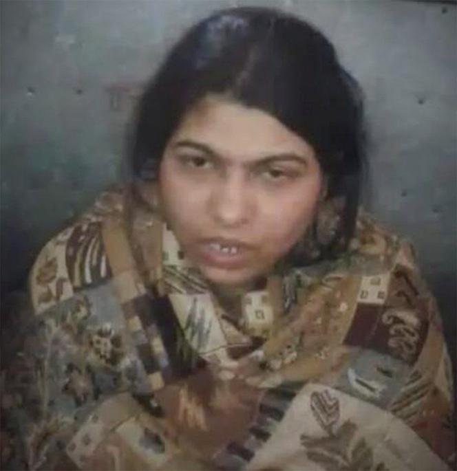 odgryzła mężowi penisa