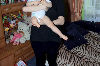 Maja czeka na protezę