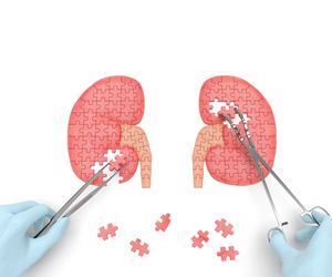 Nerka ruchoma (wędrująca) - przyczyny, objawy i leczenie