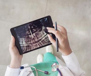 Pantomogram - zdjęcie pantomograficzne. Na czym polega? Kiedy jest potrzebny? 