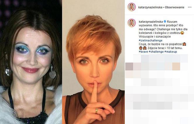 Katarzyna Zielińska pokazała w mediach społecznościowych jak zmieniła się jej twarz