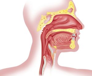 Rak gardła: przyczyny. Jakie są czynniki ryzyka rozwoju raka gardła?