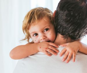 Ospa poronna - łagodna i skąpoobjawowa postać ospy wietrznej
