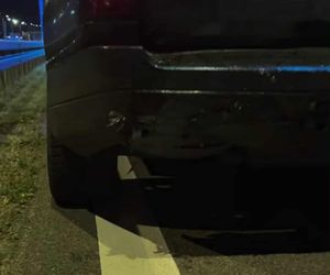 Uwielbiany muzyk uległ wypadkowi. Pokazał zdjęcia! Koncert odwołano