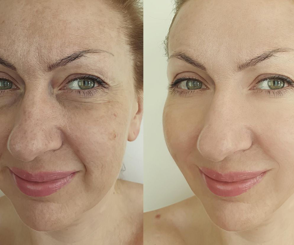 Kosztuje 1 zł, a daje efekt jak zabieg za 600 zł. Masz je w swojej lodówce