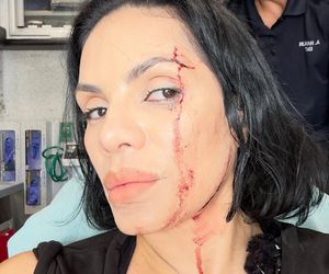 Influencerka kręciła film na Instagrama. Nagle uderzyło w nią auto!