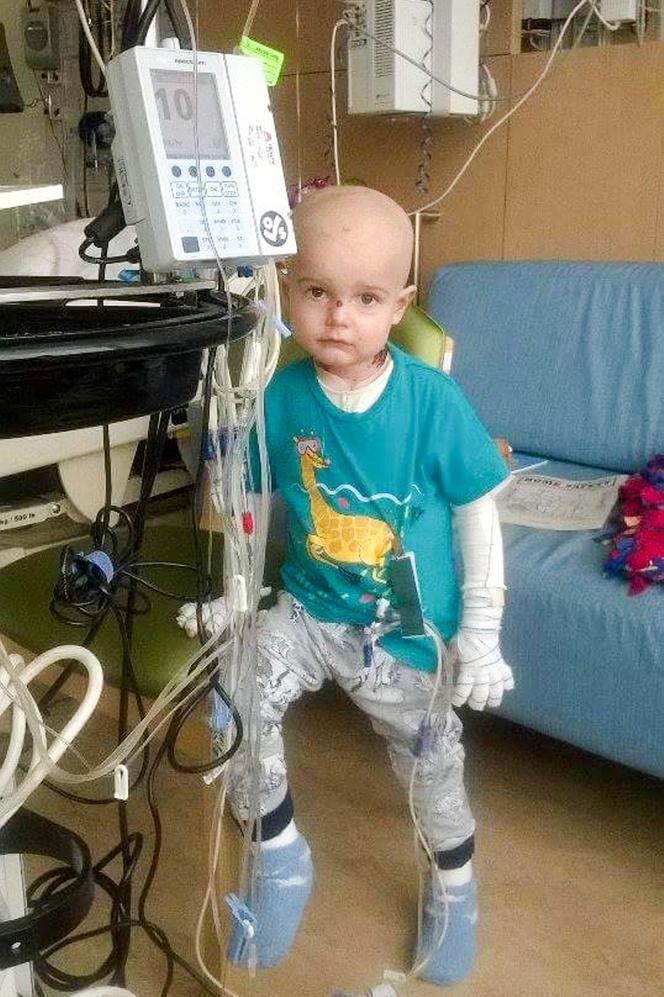 Moja skóra mnie zabija