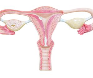 Wodniak jajowodu: przyczyny, objawy, leczenie