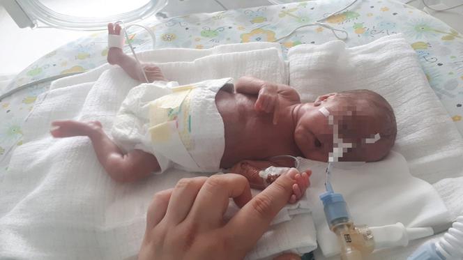 Lilianka wygrała walke o życie