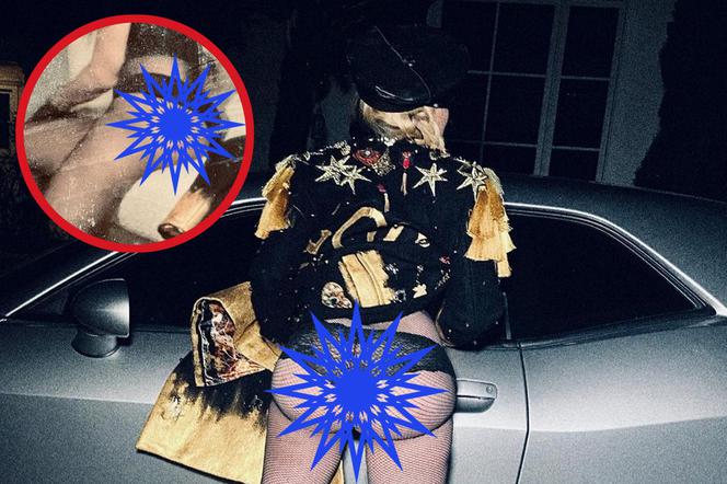 Madonna pokazała spory kawałek ciała. Przesadziła z operacjami?