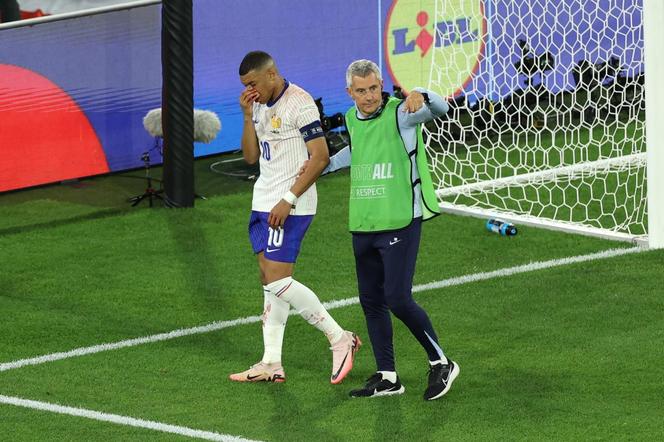 Kontuzja nosa Mbappe podczas Euro 2024