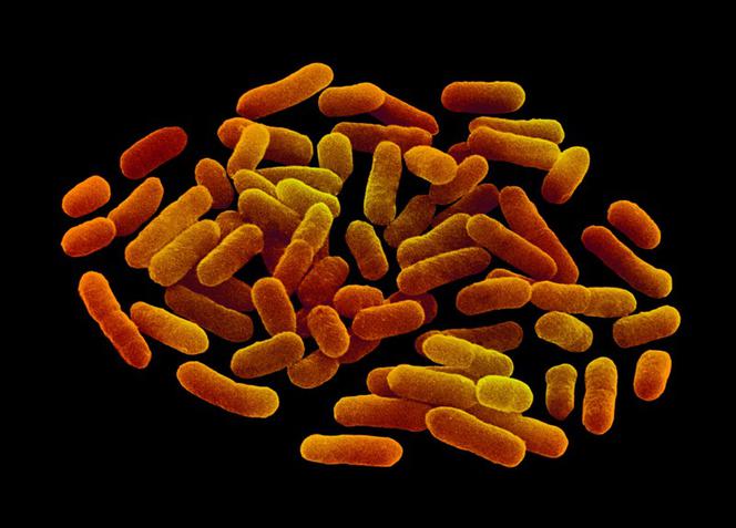 10 osób zmarło po zakażeniu bakterią E. coli. - winne są skażone ogórki