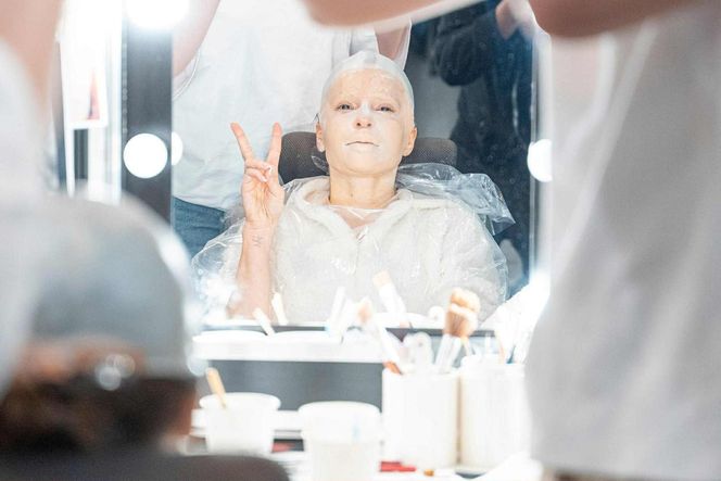 Edyta Herbuś - łysa śpiewaczka