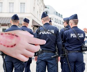 Agresywny 40-latek pogryzł policjanta! Wesoły festyn przerodził się w koszmar