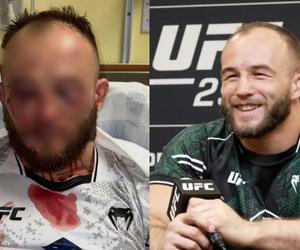 Zmasakrowana twarz polskiej gwiazdy UFC. Aż serce się kraje na ten widok