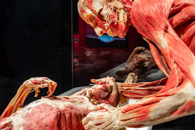 Kontrowersyjna wystawa Body Worlds wraca do Katowic. Zobaczymy ją w galerii Szyb Wilson