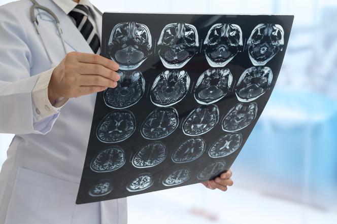 Doktor analizuje zdjęcia tomografii mózgu