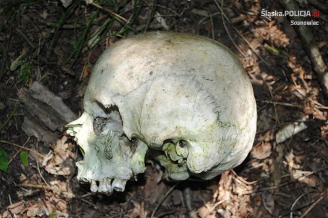 W Sosnowcu znaleziono ludzka czaszke