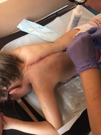 Leczenie w Polsce nie przynosiło rezultatów