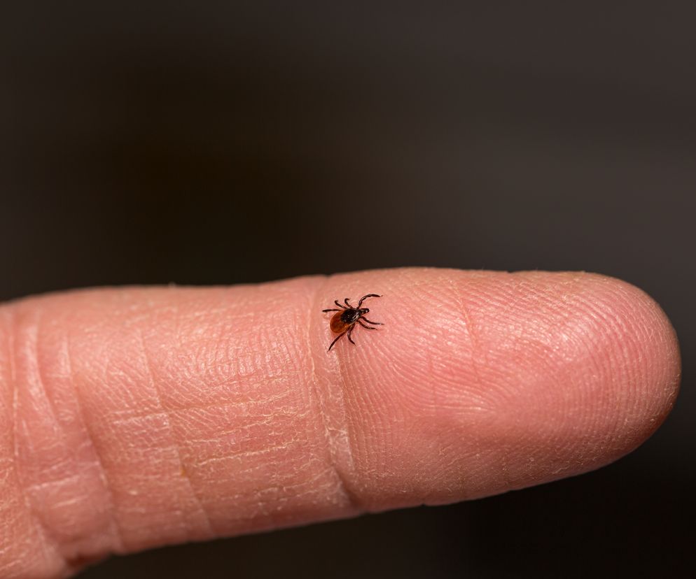 Genialny sposób na kleszcze. Kosztuje 15 zł, a działa lepiej niż produkty ze sklepu
