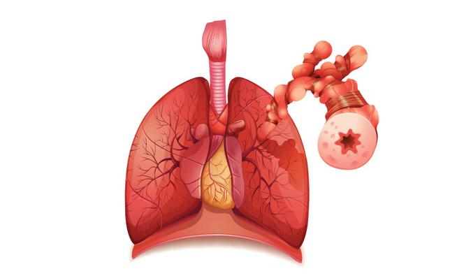 Wziernikowanie jamy opłucnej - badanie płuc i opłucnej