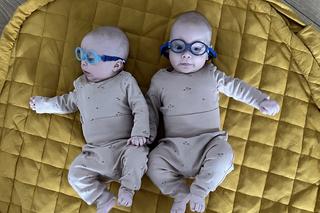 Apel o pomoc dla bliźniaków