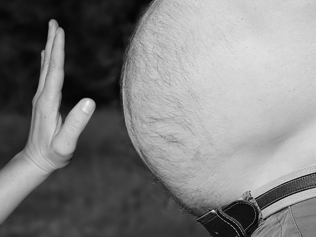 Mieszkaniec Płocka schudł 117 kg! Wcześniej drwiły z niego nawet byłe dziewczyny...