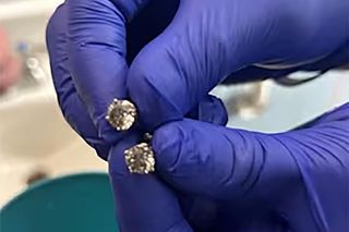 Ukradł diamentowe kolczyki i je połknął. Policja w końcu je odzyskała