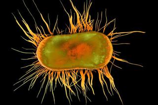Bakteria coli: Sanepid bada grupę dzieci – byli na zawodach w Berlinie