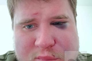 Zaginął Zbigniew Kozubiński. Wracał do Polski z Niemiec, ktoś go dotkliwie pobił. Zdjęcia poszukiwanego