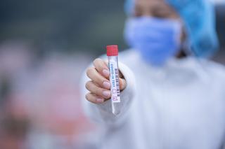 Koronawirus w Polsce: Spadek zakażeń. Co dane mówią o pandemii? [RAPORT, 12.12.2020]
