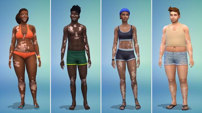 Bielactwo w The Sims 4 - zobacz, jak wyglądają simowie z nową cechą wyglądu