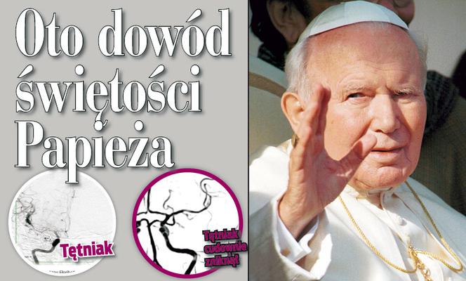 Oto dowód świętości Papieża