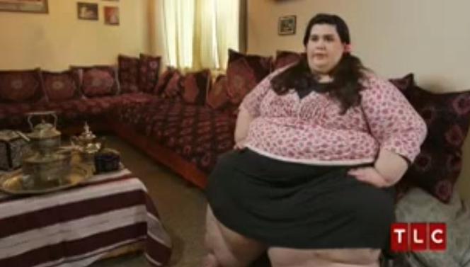 Ta kobieta waży ponad 300 kg! Szoruje fałdy tłuszczu na nogach szczotką do mycia pleców! [ZDJĘCIA]