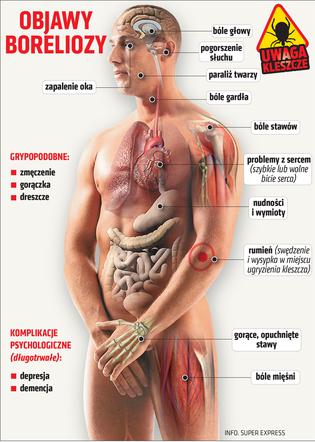 Bolerioza infografika