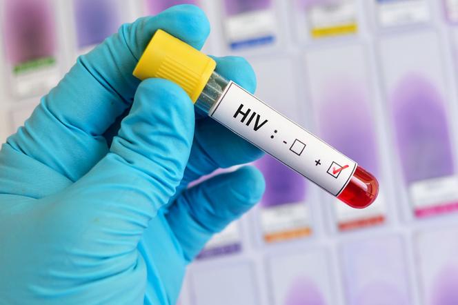Test na HIV. Czy test na HIV można wykonać w domu? Gdzie zrobić test na HIV bezpłatnie i anonimowo?