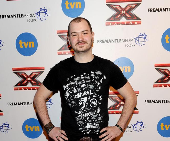 William Malcolm, X Factor