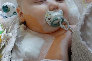 Adaś Krzyżanowski potrzebuje leczenia. Nowotwór zżera jego malutkie oczko