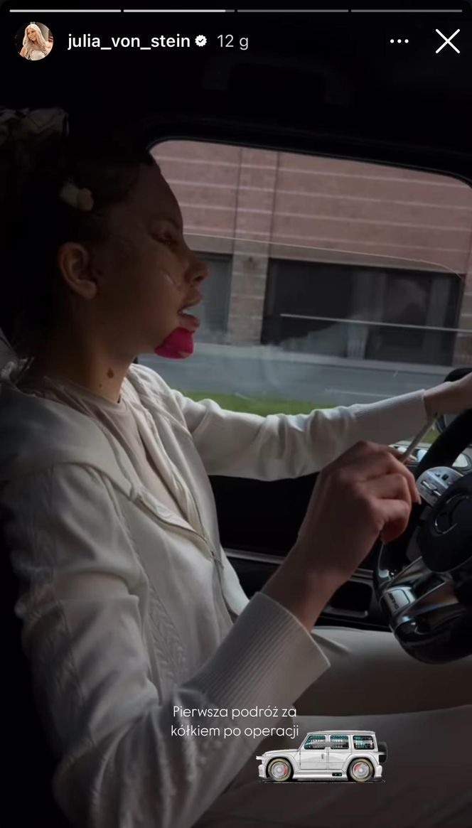 Julia von Stein po operacji