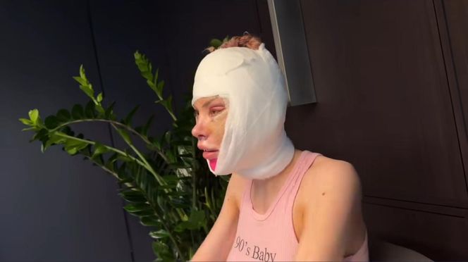 Julia Von Stein po operacji 